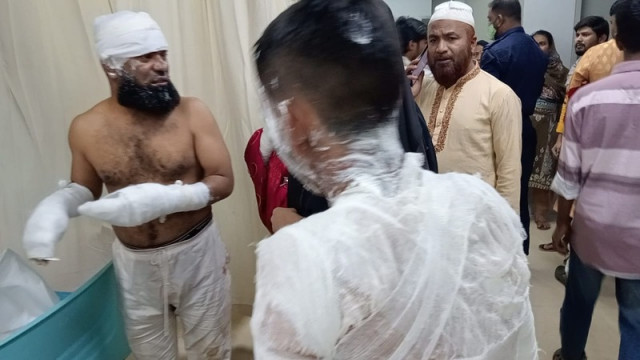 Victims of the gas leak explosion being treated at Dhaka Medical College burn unit after the incident in Ashulia.