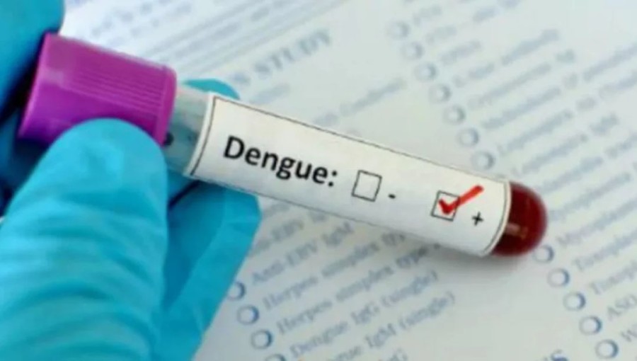 373 dengue patients hospitalized