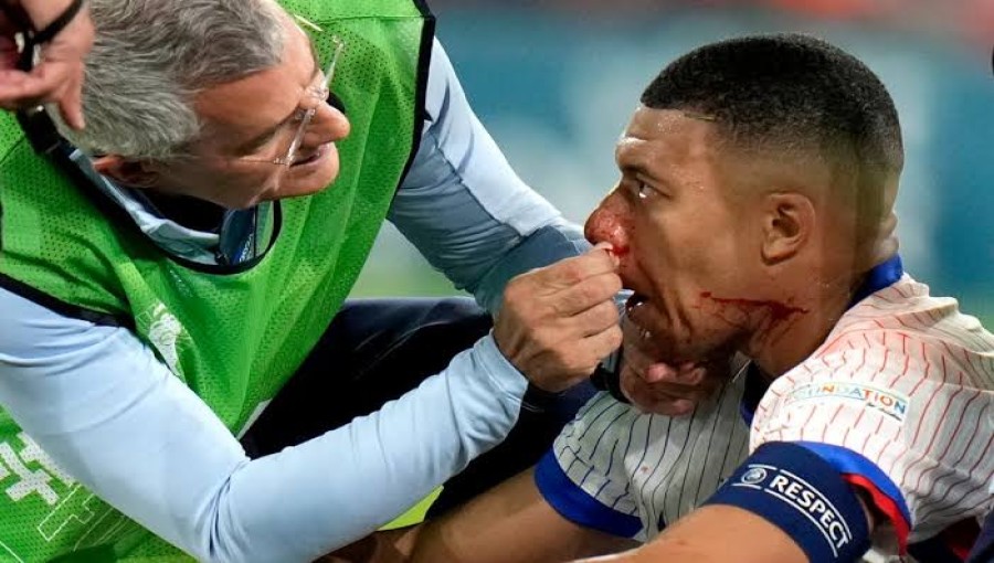 Kylian Mbappe to Wear Protective Mask After Suffering Broken Nose in Euro 2024 Opener