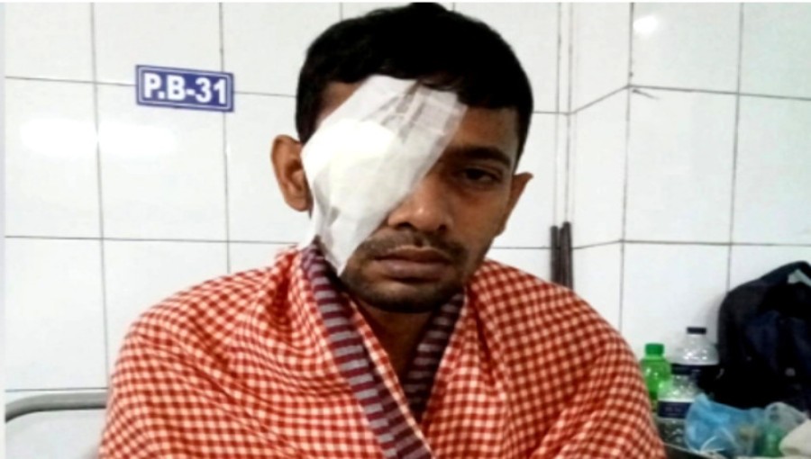 Blinded by Police Fire During Student Protest, Al Amin Seeks Financial Help for Eyes