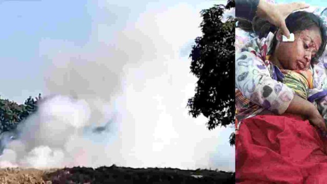 Child Critically Injured by Bullet from Myanmar at Teknaf Border