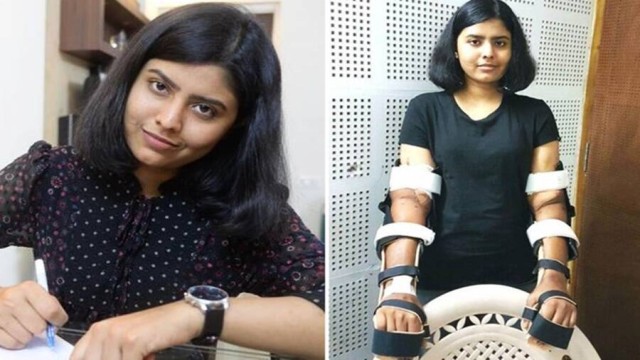 Indian Woman Undergoes First Successful Male-to-Female Hand Transplant