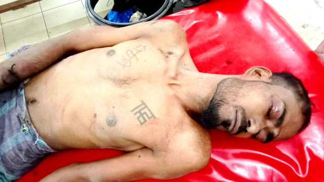 Injured suspect Alamin captured by locals and handed over to police.