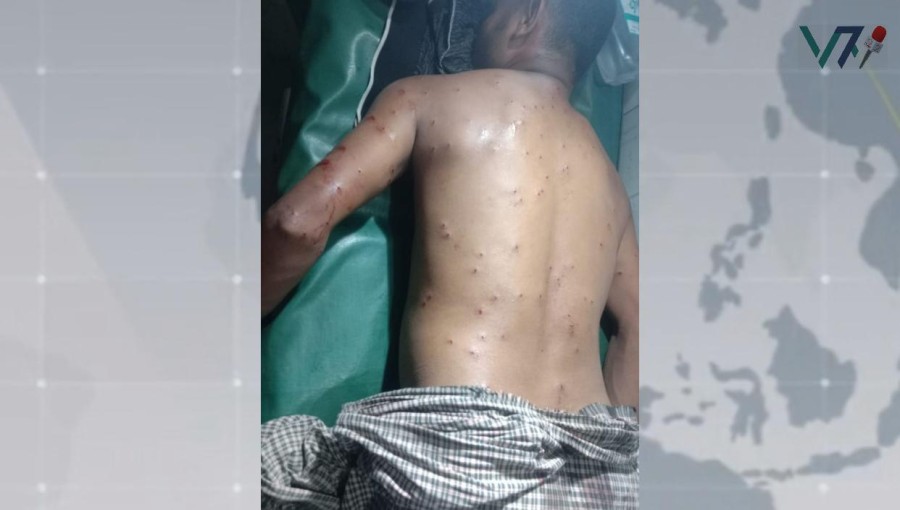 Rohingya camp in Ukhiya, Cox's Bazar, witnesses aftermath of triangular conflict as ARSOs target shops and homes, leaving ten injured. Photo: Voice7 News