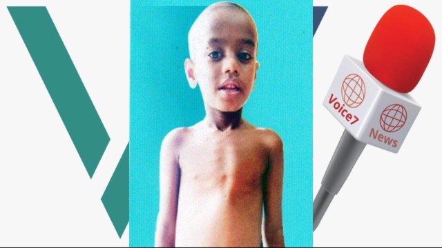 Child Jisan Needs Tk 9 Lakh for Life-Saving Heart Surgery